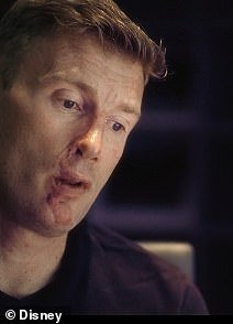 Flintoff has spoken in detail about the extent of his injuries from the crash nearly three years on