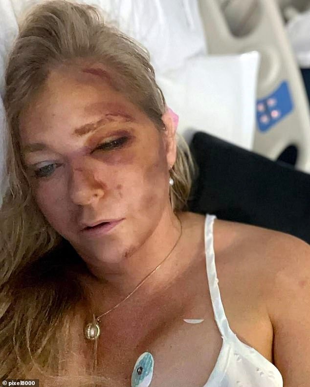 In March, Ms Giuffre shared images of herself to Instagram from a hospital bed after being in a car crash, stating doctors told her she had just days to live