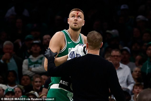 Celtics star Kristaps Porzingis suffered a gruesome injury during Game 2 of the NBA playoffs
