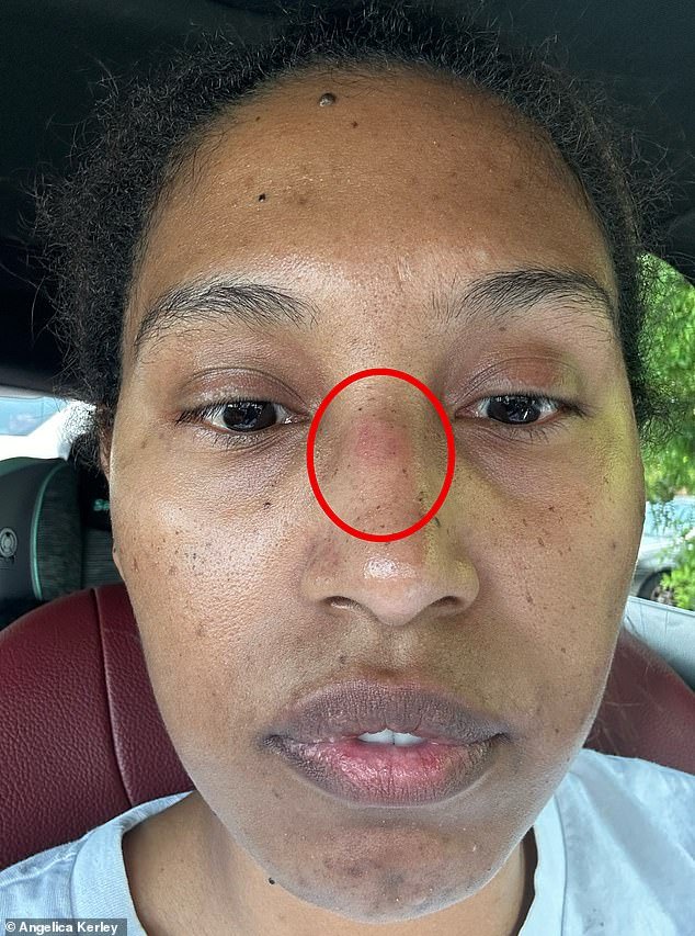 Angelica said Kerley dragged her off the bed which led her to land face first on the wooden floor, bashing her nose