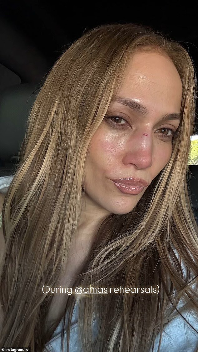 Lopez suffered a potentially career-altering injury that required quick action from a celebrity plastic surgeon