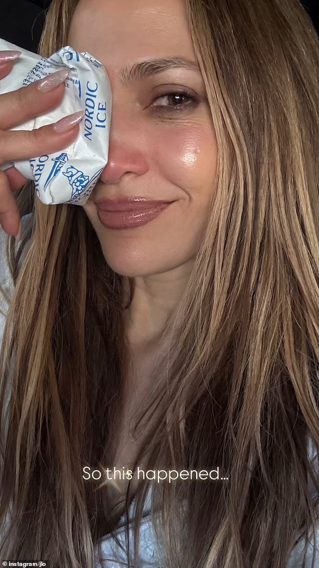 The siren revealed in an Instagram Stories post that she had injured her face in the course of rehearsals for the upcoming awards ceremony