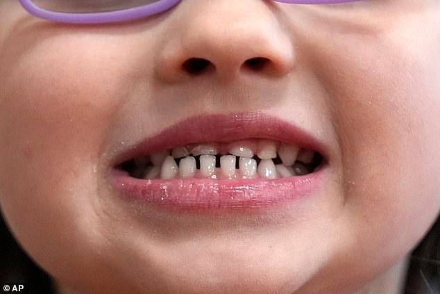 These tablets are usually recommended for children that are at an increased risk of tooth decay or cavities due to low fluoride in their local drinking water